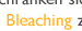 Zahnkosmetik - Bleaching